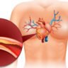 Signs that bad cholesterol is increasing in the body in tamil