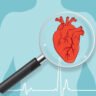 What are the visible signs of body parts before a heart attack